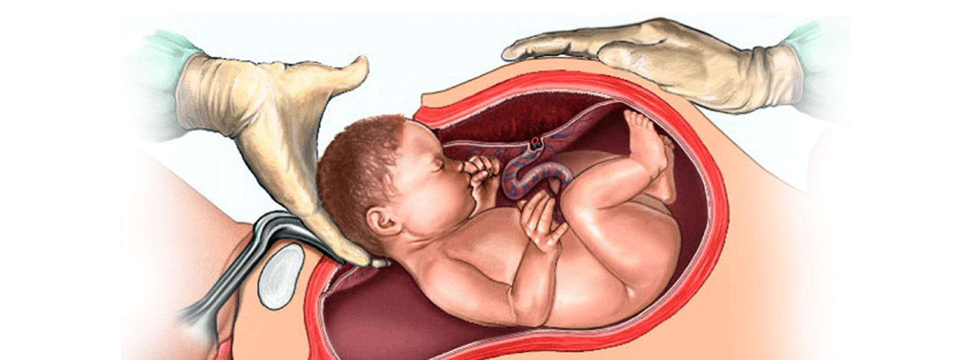 8 Gynecology