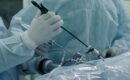 laparoscopy for infertility