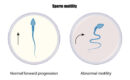 Normal sperm motility